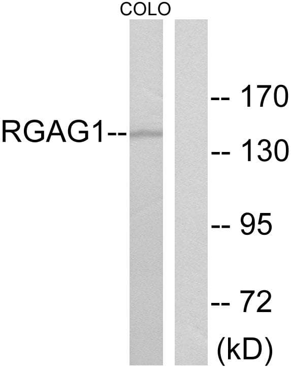 RGAG1 Antibody