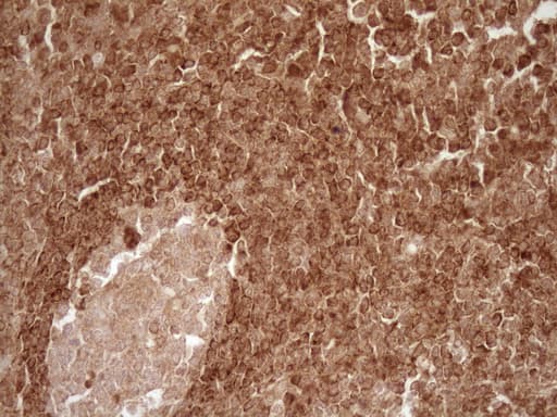 BCL2 / Bcl-2 Antibody (clone OTI9D3)