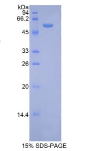 Mouse RPN1 / Ribophorin I Protein (Recombinant His-GST)