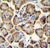 Radil Antibody (aa1044-1071)