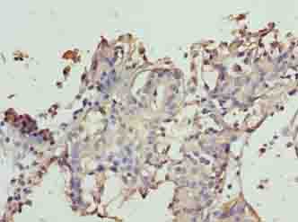Polyclonal Rabbit anti-Human TTC9C Antibody (IHC, WB)
