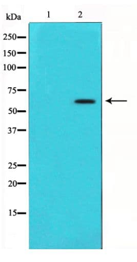 AKT1 Antibody (phospho-Ser473)