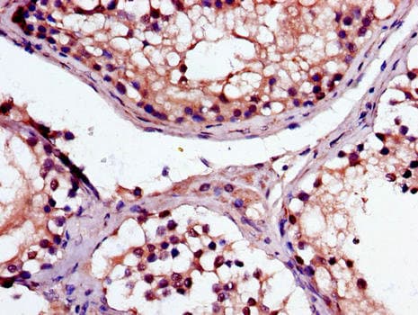 MAK Antibody
