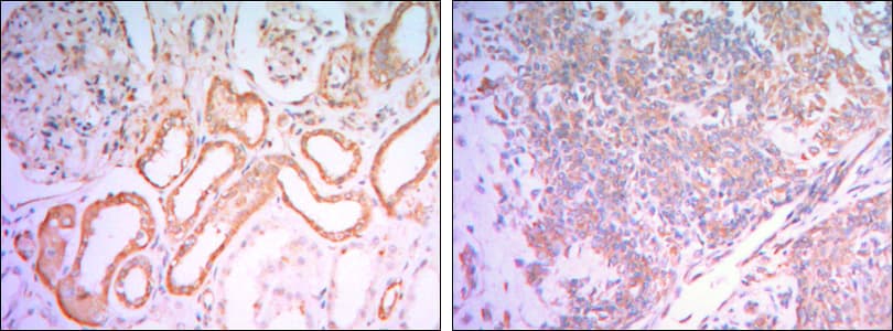 HK1 / Hexokinase 1 Antibody (clone 7A7)