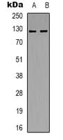 POLR3B Antibody (Internal)