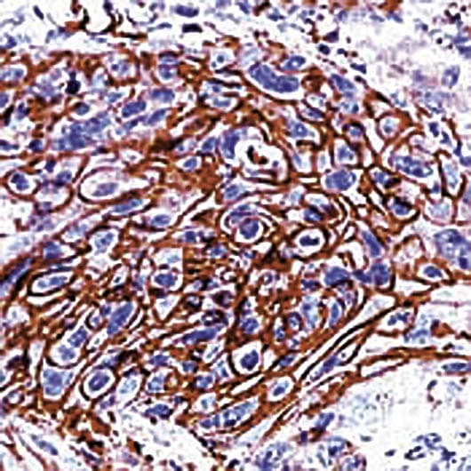 Polyclonal Rabbit anti-Human SLC2A1 / GLUT-1 Antibody (C-Terminus, IHC)