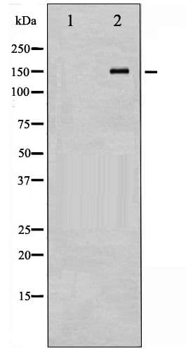 PDGFRA / PDGFR Alpha Antibody (phospho-Tyr849)