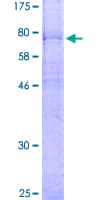 Human FZD4 / Frizzled 4 Protein (Recombinant GST)