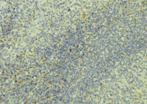 SELL / L-Selectin / CD62L Antibody