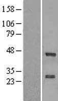 ZNF191 / ZNF24 Protein (Over-Expression Lysate Myc-DDK (Flag))