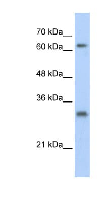 Polyclonal Rabbit anti-Human USP39 Antibody (N-Terminus, IHC, WB)