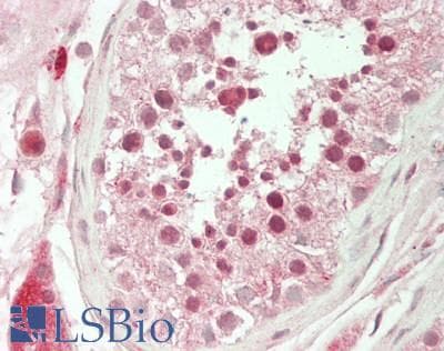 IHC-plus™ Polyclonal Rabbit anti-Human DOT1L / DOT1 Antibody (IHC, WB)