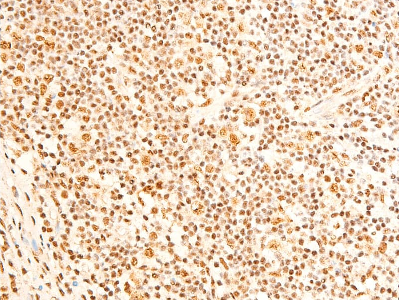Polyclonal Rabbit anti-Human FOXO3 / FOXO3A Antibody (phospho-Ser253, IHC, WB)