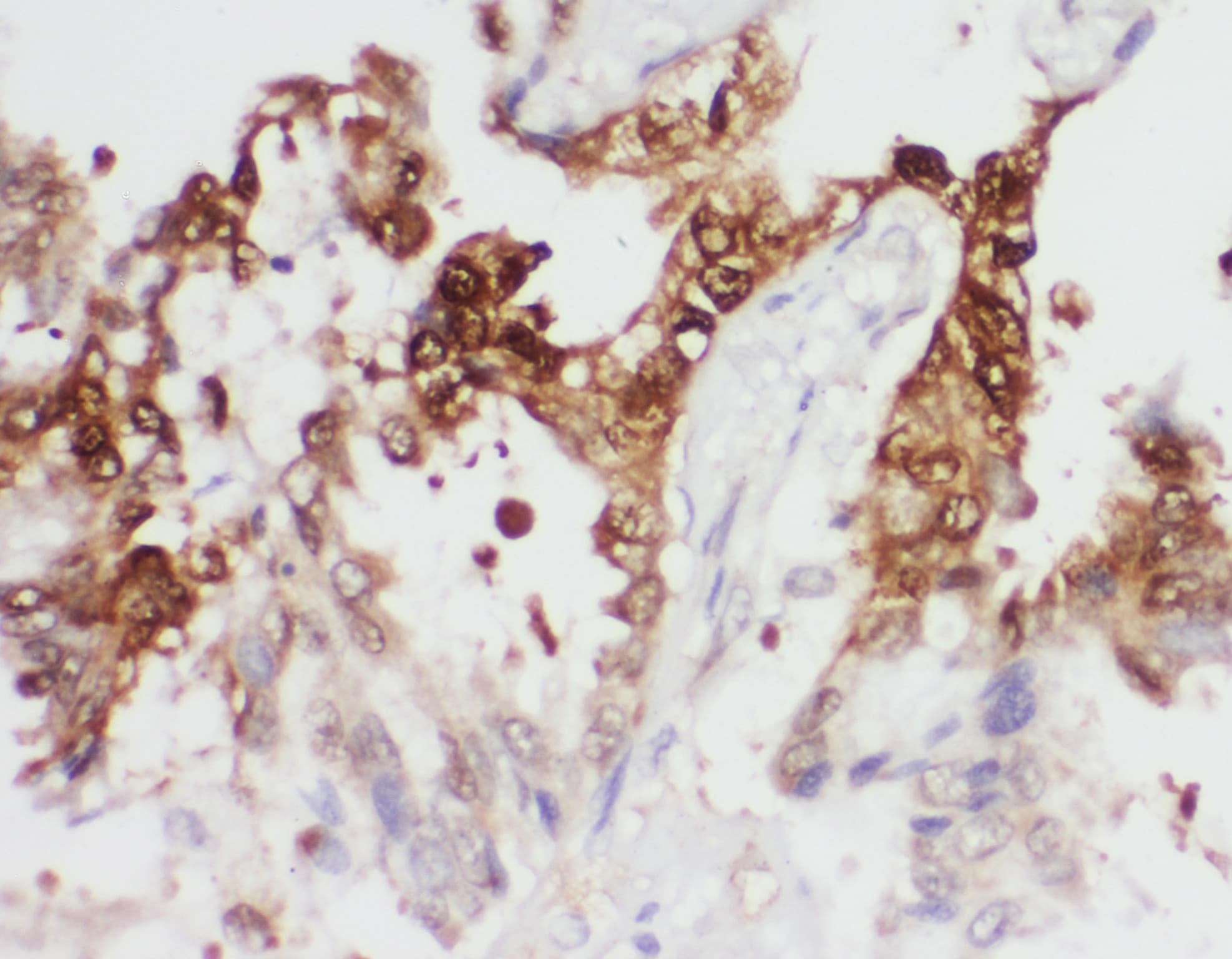 PGK1 / Phosphoglycerate Kinase Antibody (aa166-180)