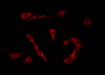 PTEN Antibody (phospho-Ser370)
