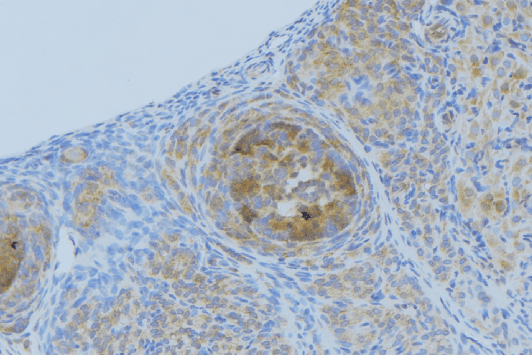 CXCL1 / GRO Alpha Antibody