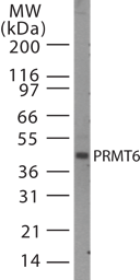 IHC-plus™ PRMT6 Antibody