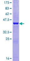 Human AG3 / AGR3 Protein (Recombinant GST)
