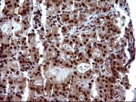 UPRT Antibody (clone OTI2D1)