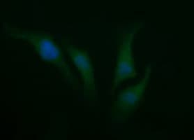 SYP / Synaptophysin Antibody (clone OTI3B12)