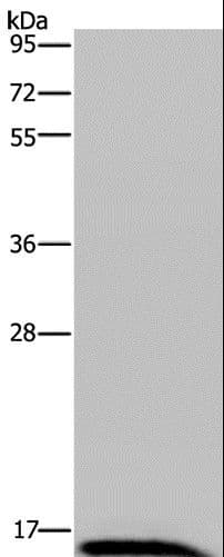 Polyclonal Rabbit anti-Human IRGM / LRG-47 Antibody (IHC, WB)