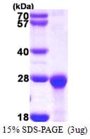 Human PCNP Protein (Recombinant His)
