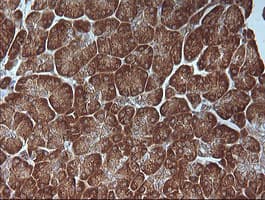 MAP2K1 / MKK1 / MEK1 Antibody (clone OTI1E5)
