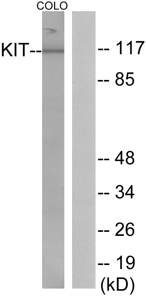 Polyclonal Rabbit anti-Human c-Kit / CD117 Antibody (aa906-955, WB)
