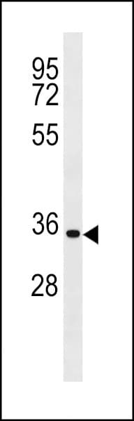 Polyclonal Rabbit anti-Human CCND2 / Cyclin D2 Antibody (aa258-285, WB)
