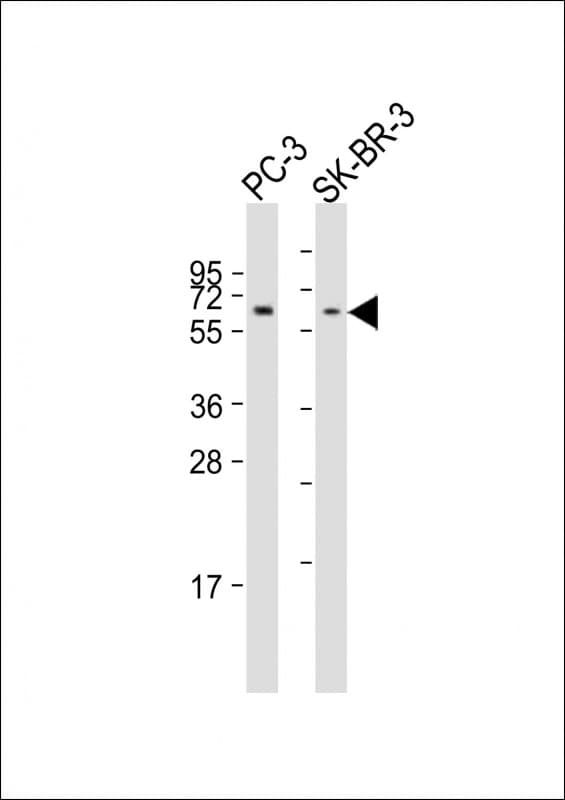 KAT5 / TIP60 Antibody (aa367-398)
