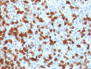 Monoclonal Rabbit anti-Human PDCD1 / CD279 / PD-1 Antibody (clone RMPD1-1, IHC)