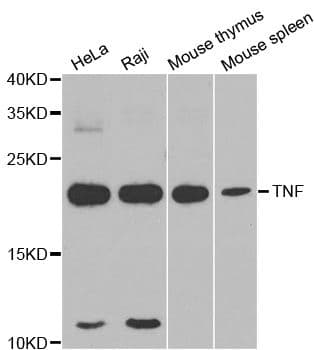 TNF Alpha Antibody