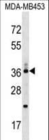 Polyclonal Rabbit anti-Human CD68 Antibody (aa209-237, WB)
