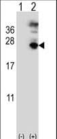 MFAP5 / MAGP2 Antibody (aa133-160)