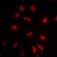 PathPlus™ HSPA9 / Mortalin / GRP75 Antibody (C-Terminus)