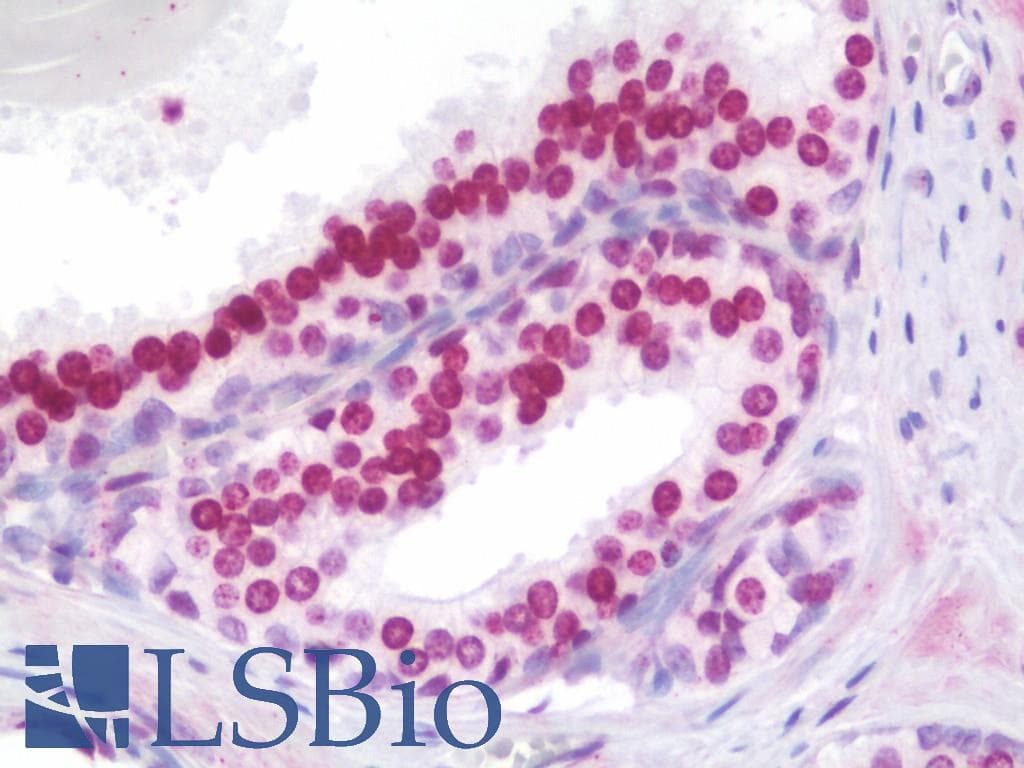 IHC-plus™ Polyclonal Rabbit anti-Human HOXA9 Antibody (aa245-272, IHC, WB)