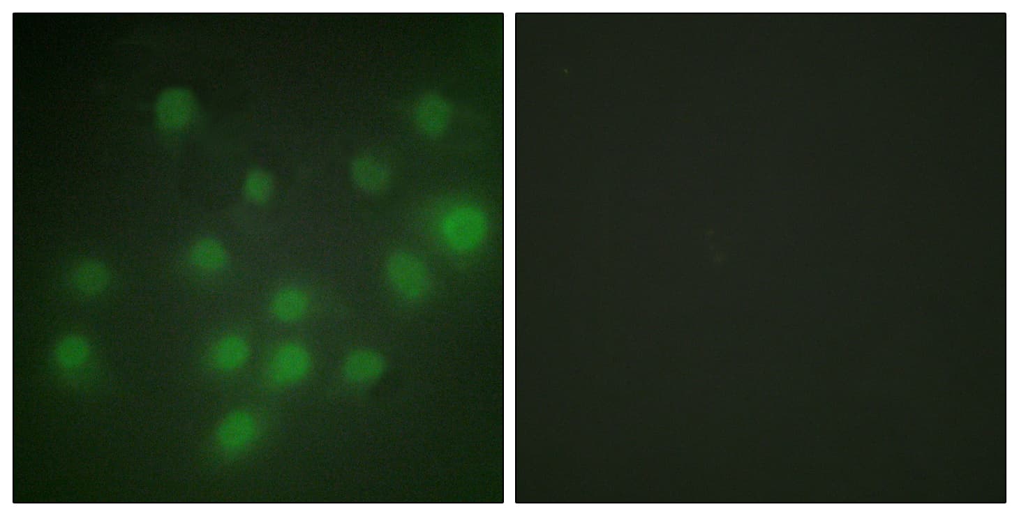 Polyclonal Rabbit anti-Human HKR1 Antibody (aa141-190, IF, WB)
