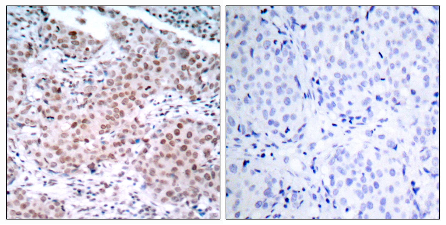 ER Alpha / Estrogen Receptor Antibody (phospho-Ser104)