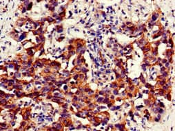 NAMPT / Visfatin Antibody