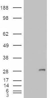 IHC-plus™ IGFBP6 Antibody (aa128-141)