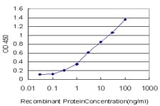 B4GALNT1 / GM2/GD2 Synthase Antibody (clone 5F9)