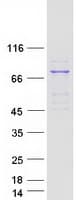 Human ACOX3 Protein (Recombinant Myc-DDK (Flag))
