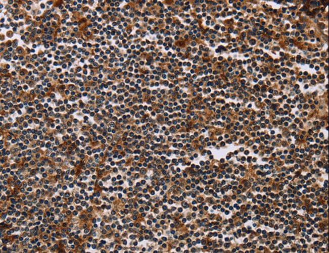 MAGEA3 Antibody