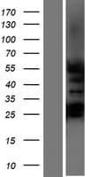 NR6A1 / GCNF Protein (Over-Expression Lysate Myc-DDK (Flag))