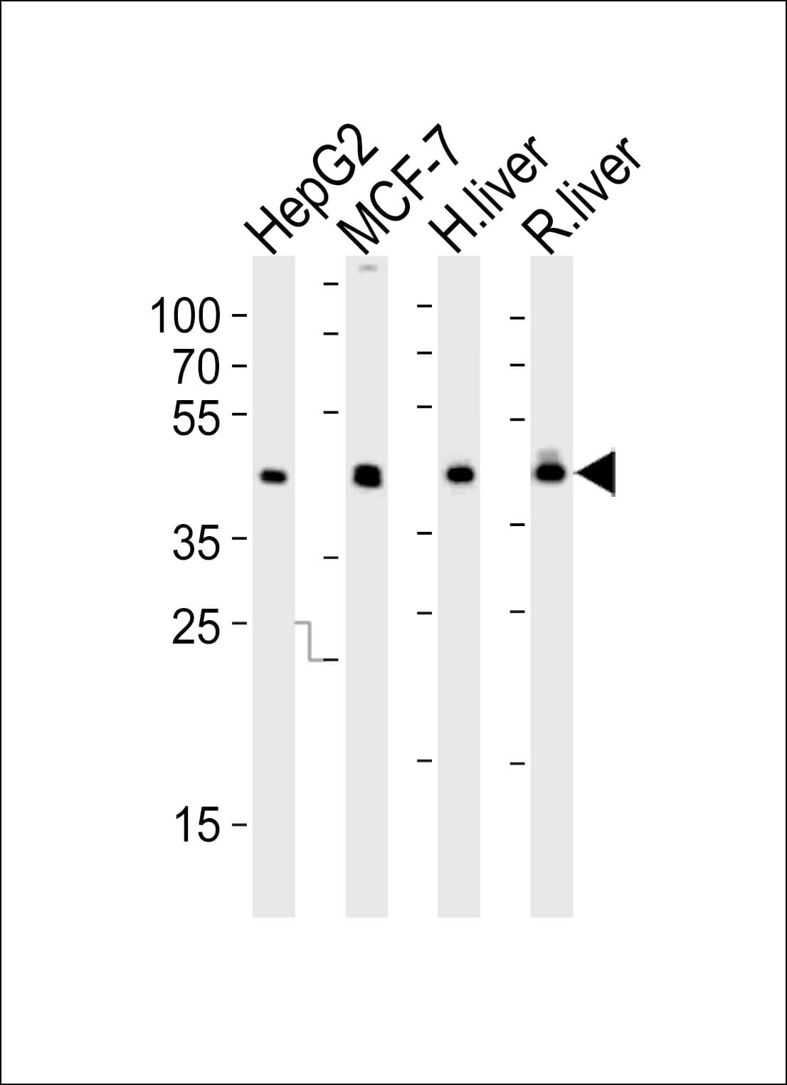PathPlus™ IDH1 / IDH Antibody (aa116-143)