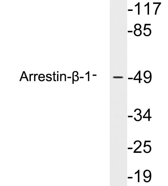 ARRB1 / Beta Arrestin 1 Antibody (aa363-412)