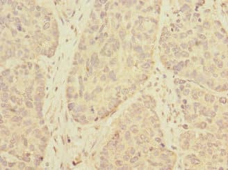 TMEM209 Antibody