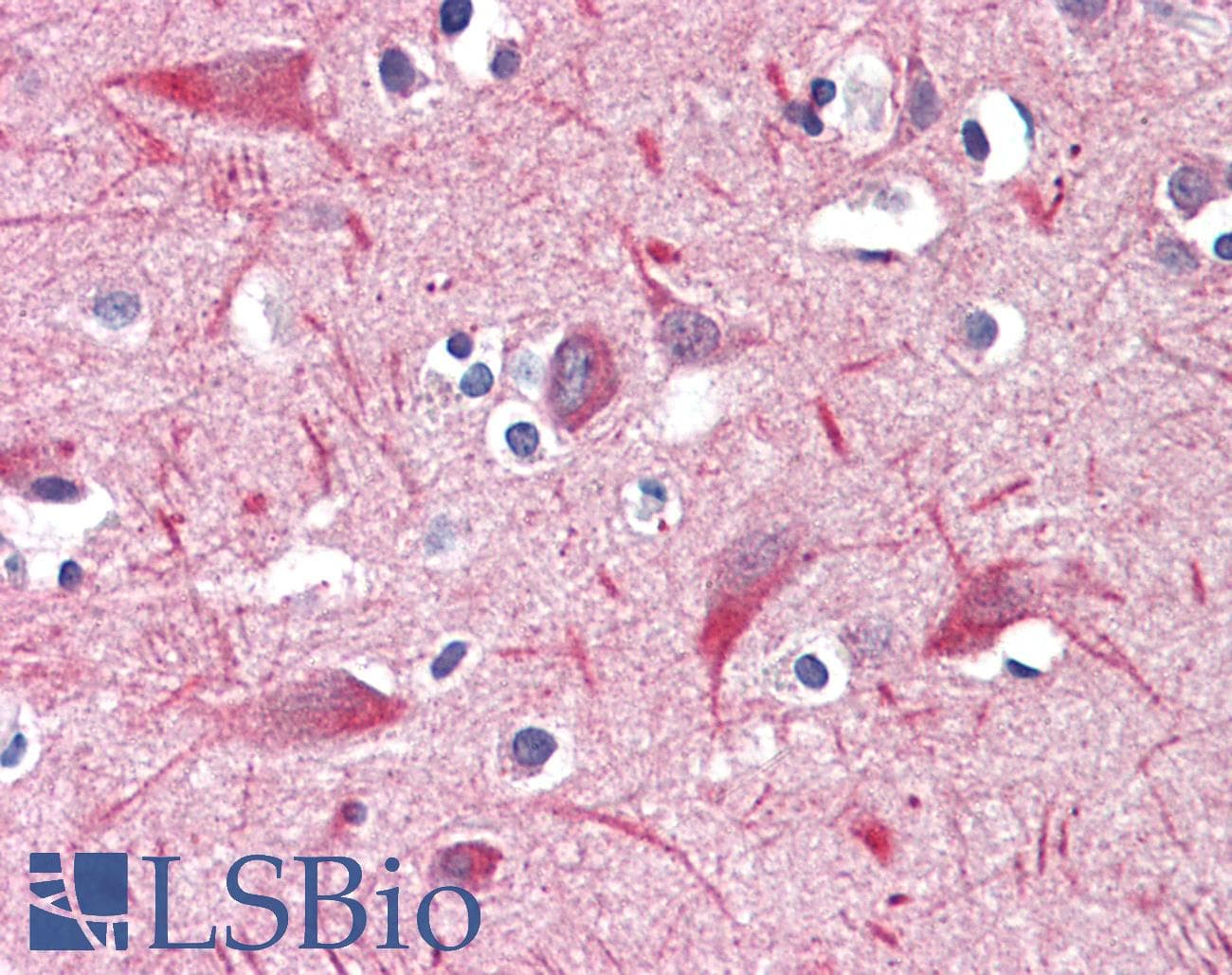 IHC-plus™ Polyclonal Goat anti-Human UBR2 Antibody (aa1618-1631, IHC)