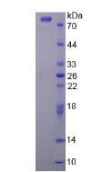 Human CHRNA7 Protein (Recombinant His-GST, N-terminus)