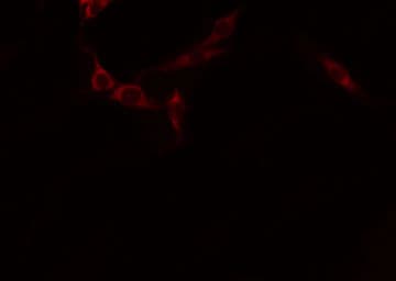 CDH16 / Cadherin 16 Antibody
